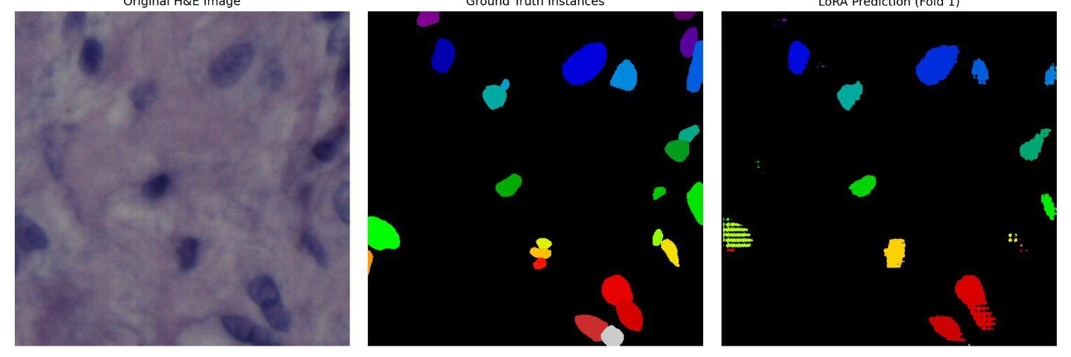 H&E tile, ground-truth nuclei instances, and LoRA predictions side by side