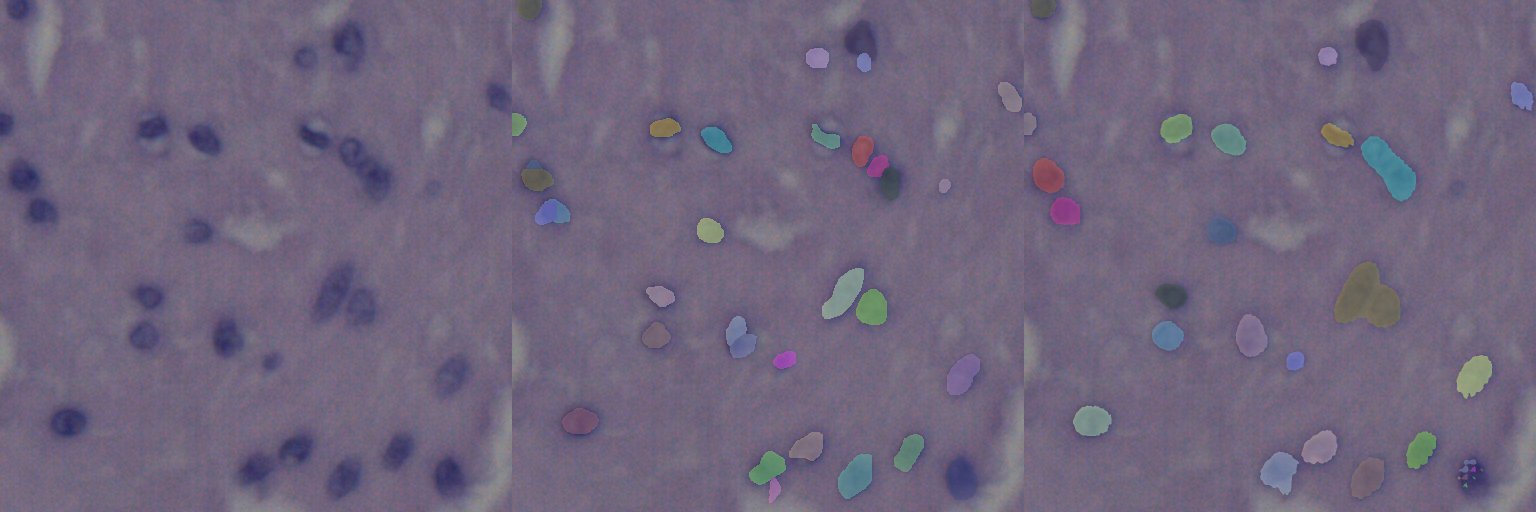 Validation H&E tile, ground-truth nuclei, and predictions from the 30-epoch retrained model side by side